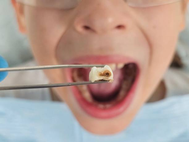 Best Urgent Dental Care for Toothaches in Emerd Mountain, AL